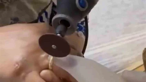 Van'da Kadının Yüzüğü Sıkıştı