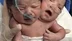 İKİ BAŞLI BEBEK DOĞDU
