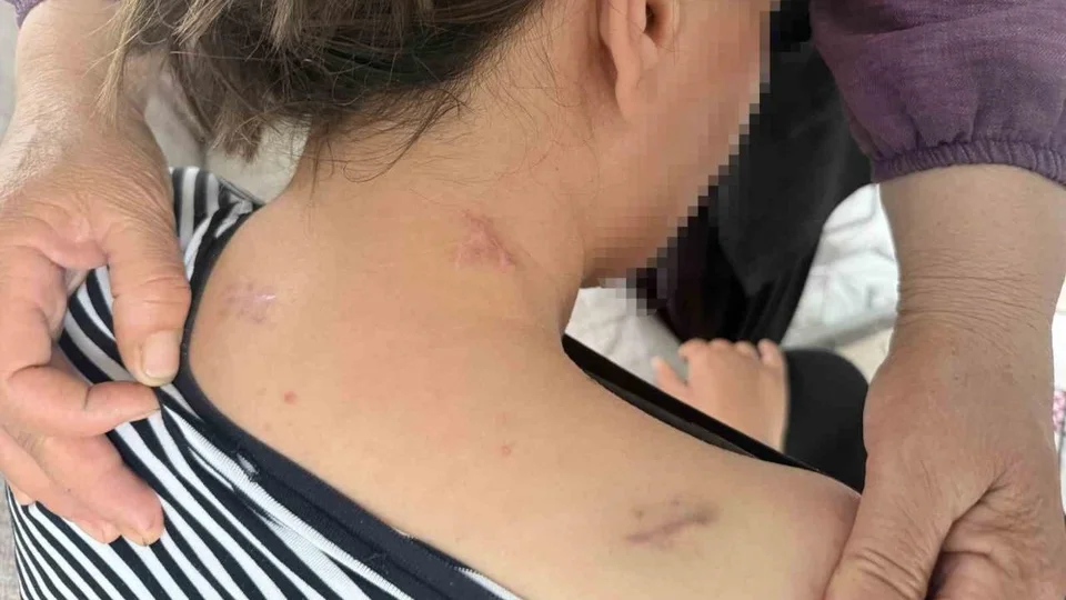 "Ölü Numarası Yaptım, Kurtuldum": Tarsus’ta 17 Bıçak Darbesiyle Yaralanan 3 Çocuk Annesi Konuştu