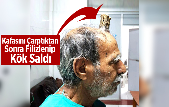 Başını Çarptıktan Sonra Filizlendi, 5 Yılda Bu Hale Geldi!