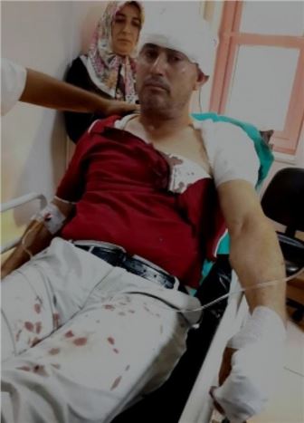 Batman'da 4 Ayrı Trafik Kazasında 11 Kişi Yaralandı