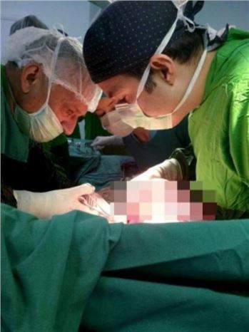 Öksürük Şikayetiyle Hastaneye Gitti Karnından 5,5 Kilo Ur Çıktı