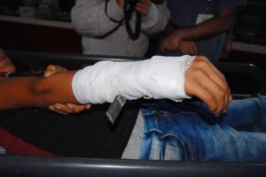 Oyun Oynarken Koluna Demir Çubuk Saplandı