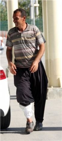 Acemi Kasap Kendini Kesince ''damdan Düştüm'' Dedi