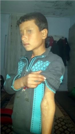 (özel Haber) Çocuğun Durumunu Değil Kazandığı Tazminatı Soruyorlar