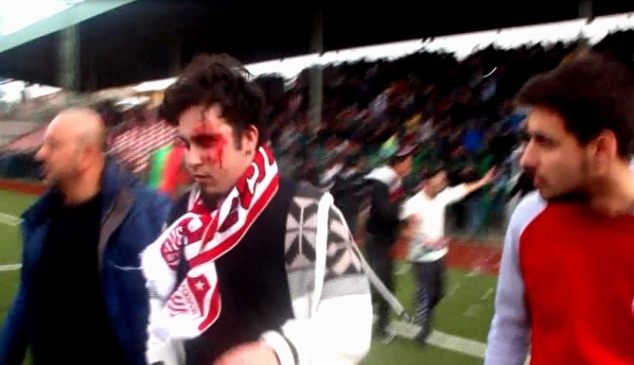 Amatör Maçta Ortalık Savaş Alanına Döndü