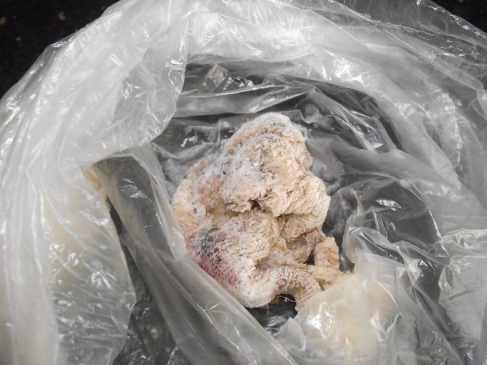 Bademcik Ameliyatı Olan Çocuğun Boğazında Gazlı Bez Unuttular