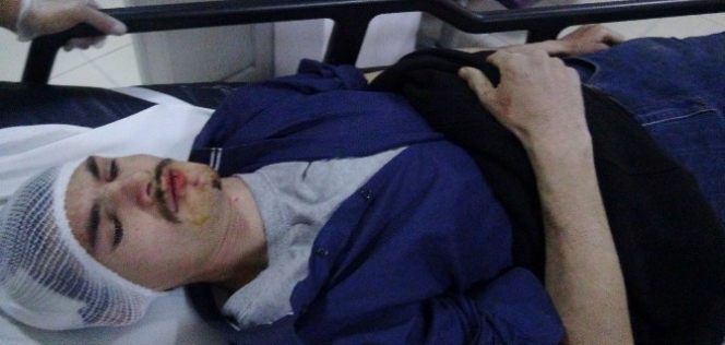 Akrabaların Tarla Kavgası Kanlı Bitti 7 Yaralı