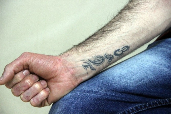 Sakarya'da Bel Fıtığı Olan Emre Öztürk'ün MR Çekimi İki Hastanede Farklı Sonuçlandı