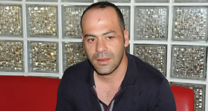 Kocaeli İzmit'te Adliye Önünde Darp Edilen Halit Okur, Adalet Arayışında