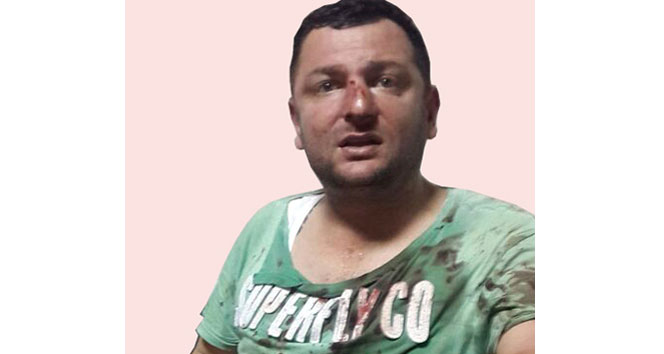 Adana Yüreğir'de Alkol Alan Grubun Şaka Yüzünden Çıkan Kavgasında 1 Kişi Hayatını Kaybetti