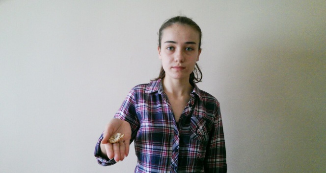 Keçiören'de Ekmekten Çıkan Demir Parçası Kızın Ağzını Kesti