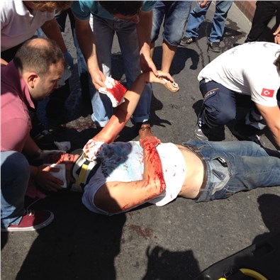 Yolun karşısına geçmeye çalışan çocuğa otomobil çarptı