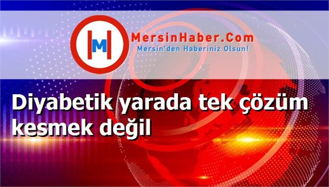 Diyabetik yarada tek çözüm kesmek değil