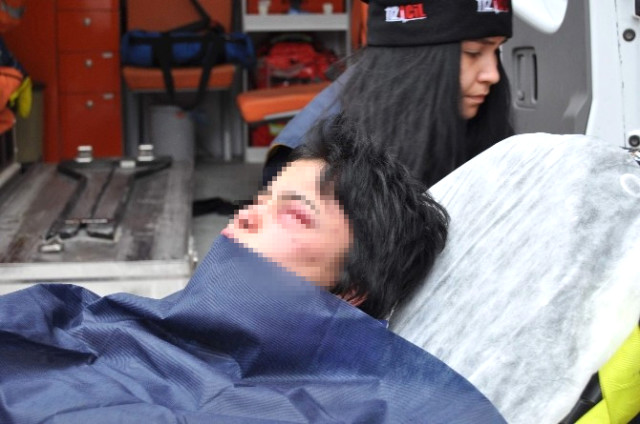 Fuhuş Çetesi 22 Yaşındaki Genç Kızı Kaçırıp Öldüresiye Dövmüş