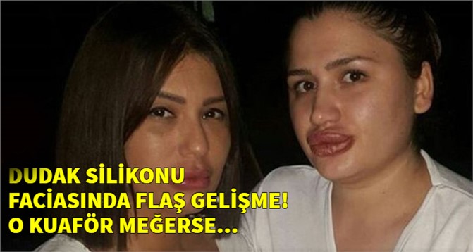 Dudak Silikonu Faciasında Flaş Gelişme