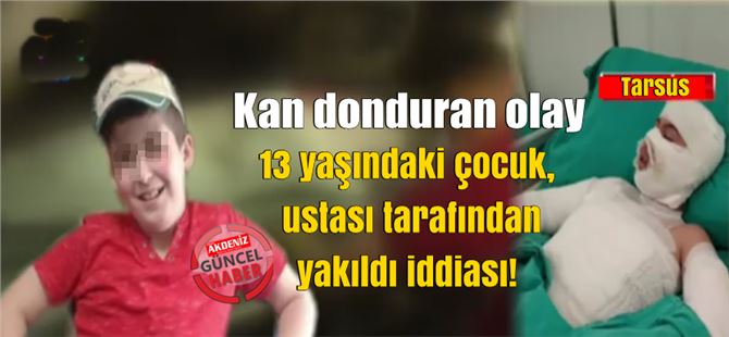 Mersin Tarsus’ta 13 Yaşındaki Çocuk, Ustası Tarafından Yakıldı İddiası!