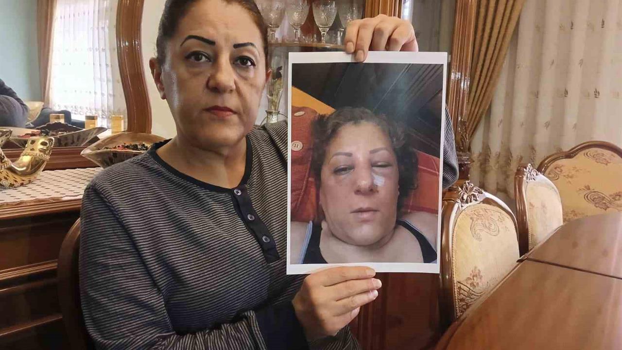 Ankara'da Komşu Kavgası: Kadın Darbedildi, Burnu Kırıldı