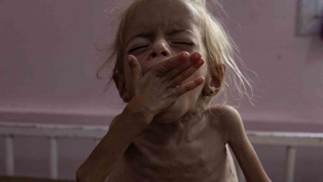 Gazze'de Açlık Sebebiyle İki Sivil Hayatını Kaybetti