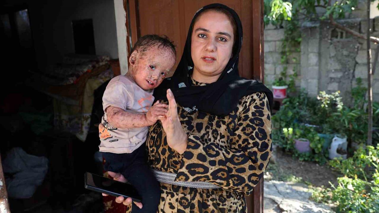 Balık pulu ve kelebek hastası Yusuf'un yardım paraları dolandırıldı