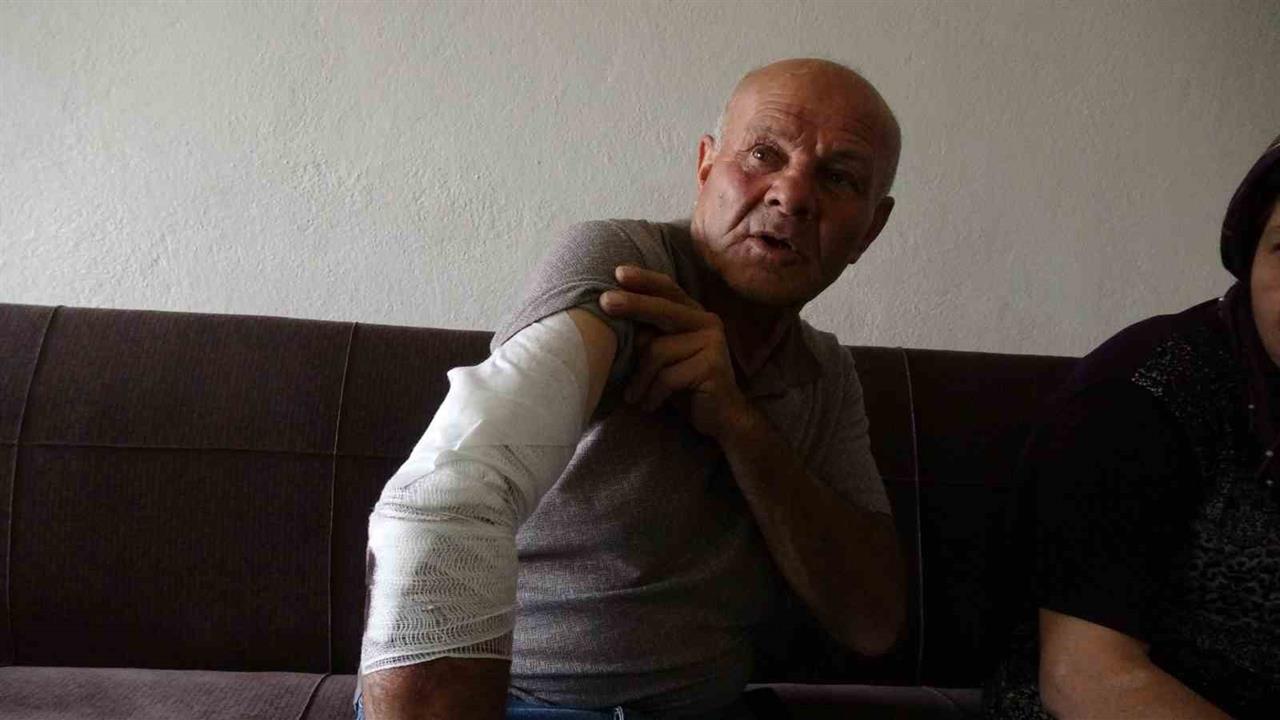 Burdur'da Köpek Saldırısı: 10 Dikişle Kurtuldu