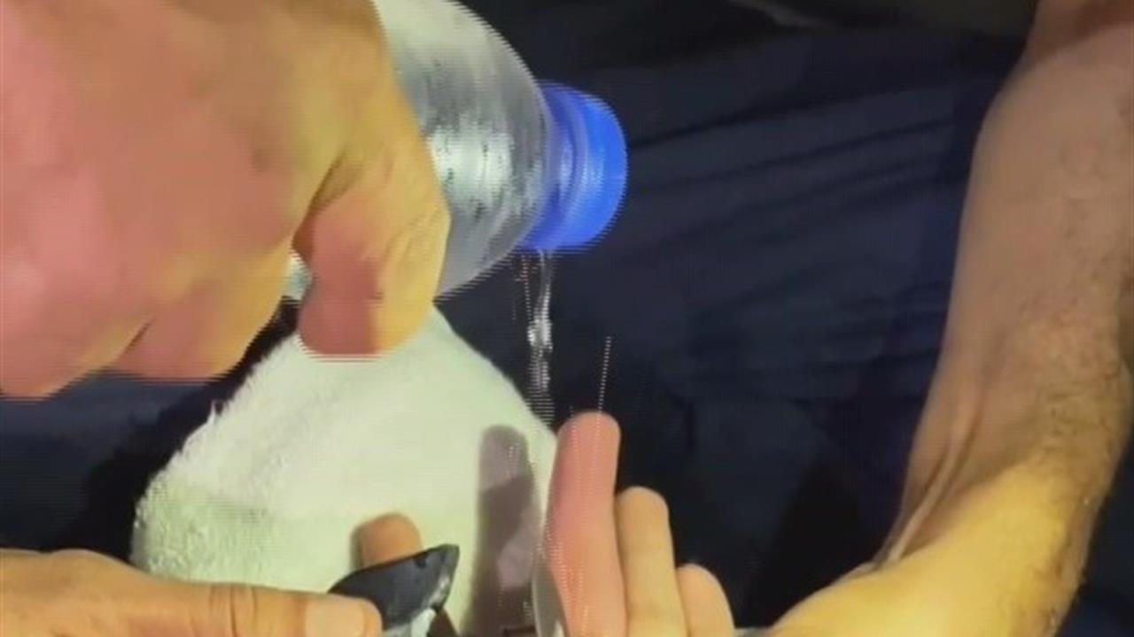 Hatay'da Parmağına Yüzük Sıkışan Vatandaşa İtfaiye Müdahale Etti