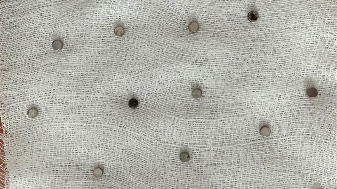 Elazığ'da 3 Yaşındaki Çocuk Mıknatıs Yuttu: 19 Adet Çıkarıldı