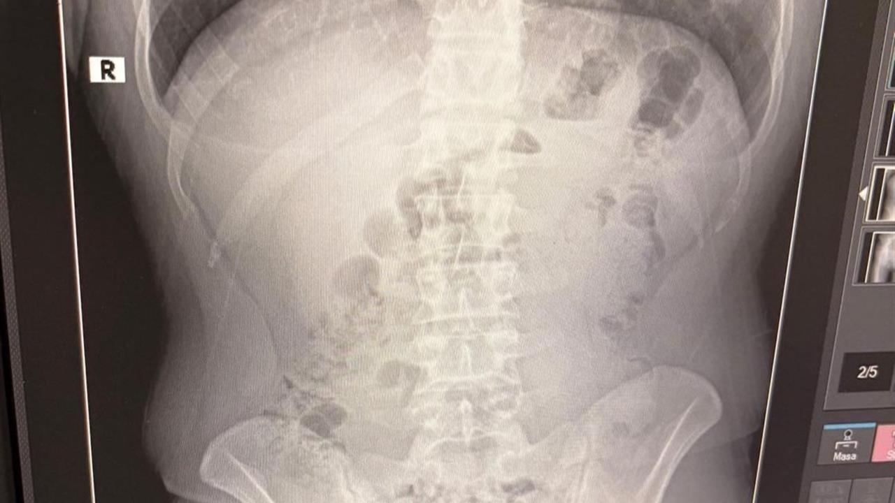 Uşak'ta Uyuşturucu Ticareti: 3 İranlı Tutuklandı