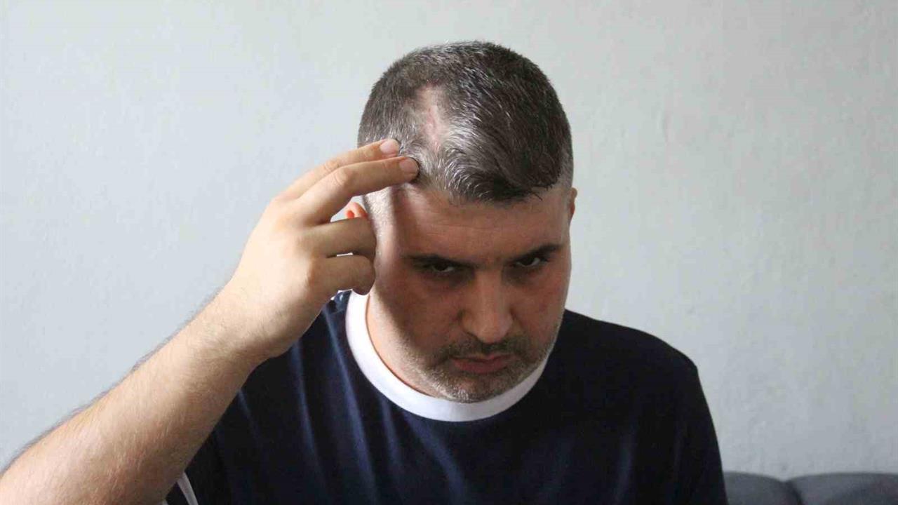 Adana'da Dayısından Beyzbol Sopalı Saldırı: Can Güvenliği Tehlikede