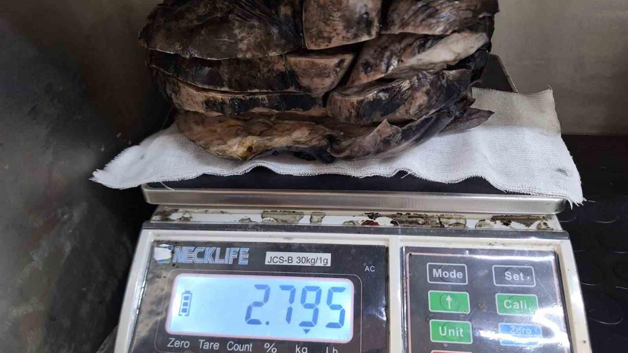 Sivas'ta Nadir Görülen Tümör Ameliyatla Alındı