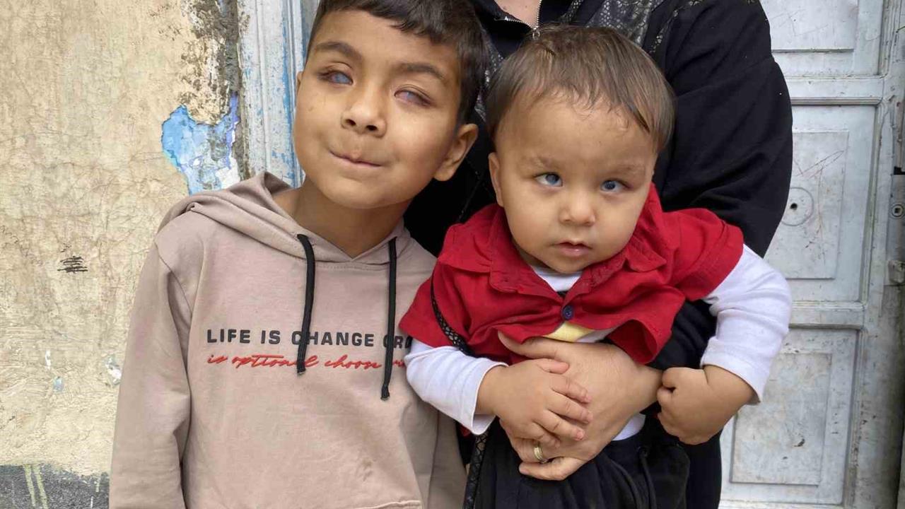 Eskişehir'de Görme Yeteneğini Kazanan Kardeşler Umut Oldu