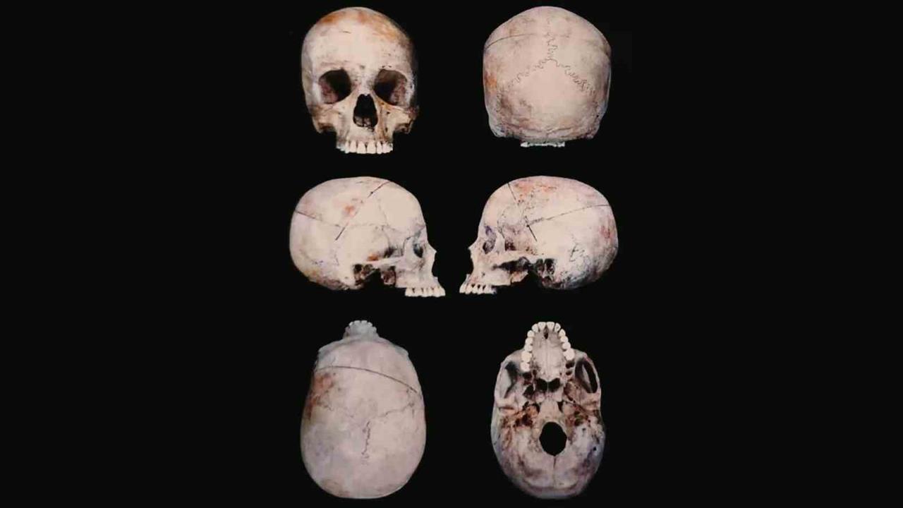 Diyarbakır'da 10 Yıl Sonra Kimliği Belirlenen Ceset Ailesine Ulaşabildi