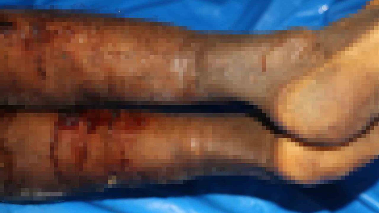 İsrail’in iade ettiği cenazelerde işkence izleri görüldü - GAZZE