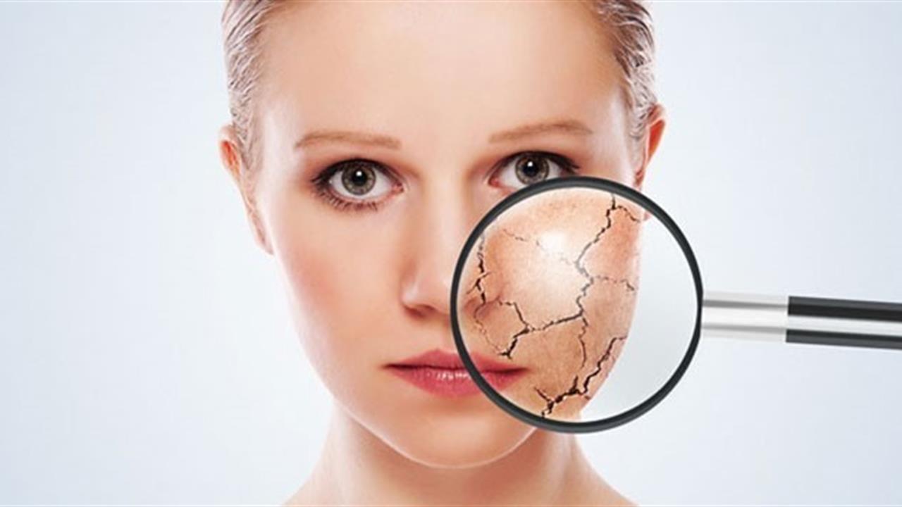 Cildiniz için kışa hazırlık reçetesi - BURSA