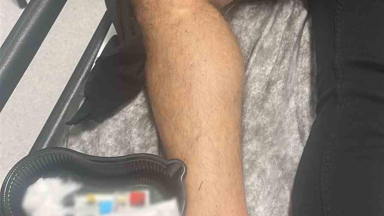 Marmaris'te Silahlı Kavga: 1 Yaralı