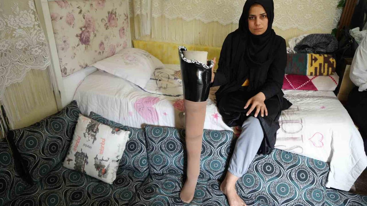 Antalya'da yaşayan Fatma Umro, Kahramanmaraş depreminde bacağını kaybetti ve eşi tarafından terk edildi.