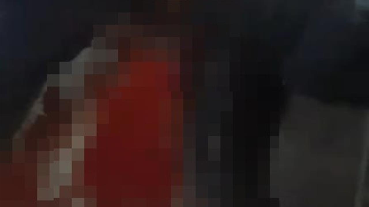 Üsküdar'da Yüksek Sesli Müzik Nedeniyle Çıkan Kavga Sonucu 1 Kişi Bıçaklandı