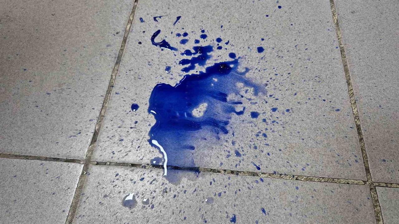 Sultangazi'de Pamuk Şeker Tüketen 5 Yaşındaki Çocuk Hastalandı