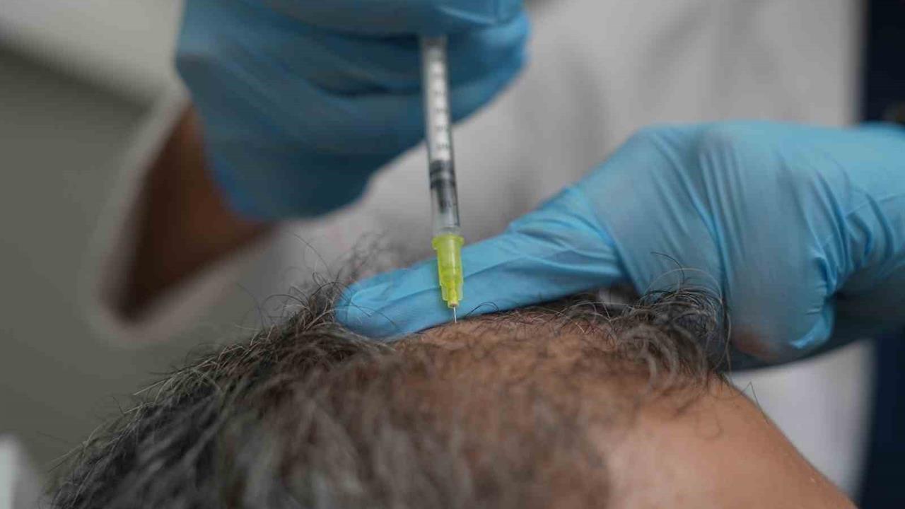 İstanbul'da Saç Dökülmesi Vücudun Alarmı Olabilir Uzmanlar Uyardı