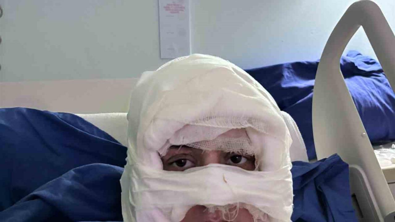 İstanbul Kadıköy'de Bir Kadın, Diğer Bir Kadın Tarafından Ateşe Verildi