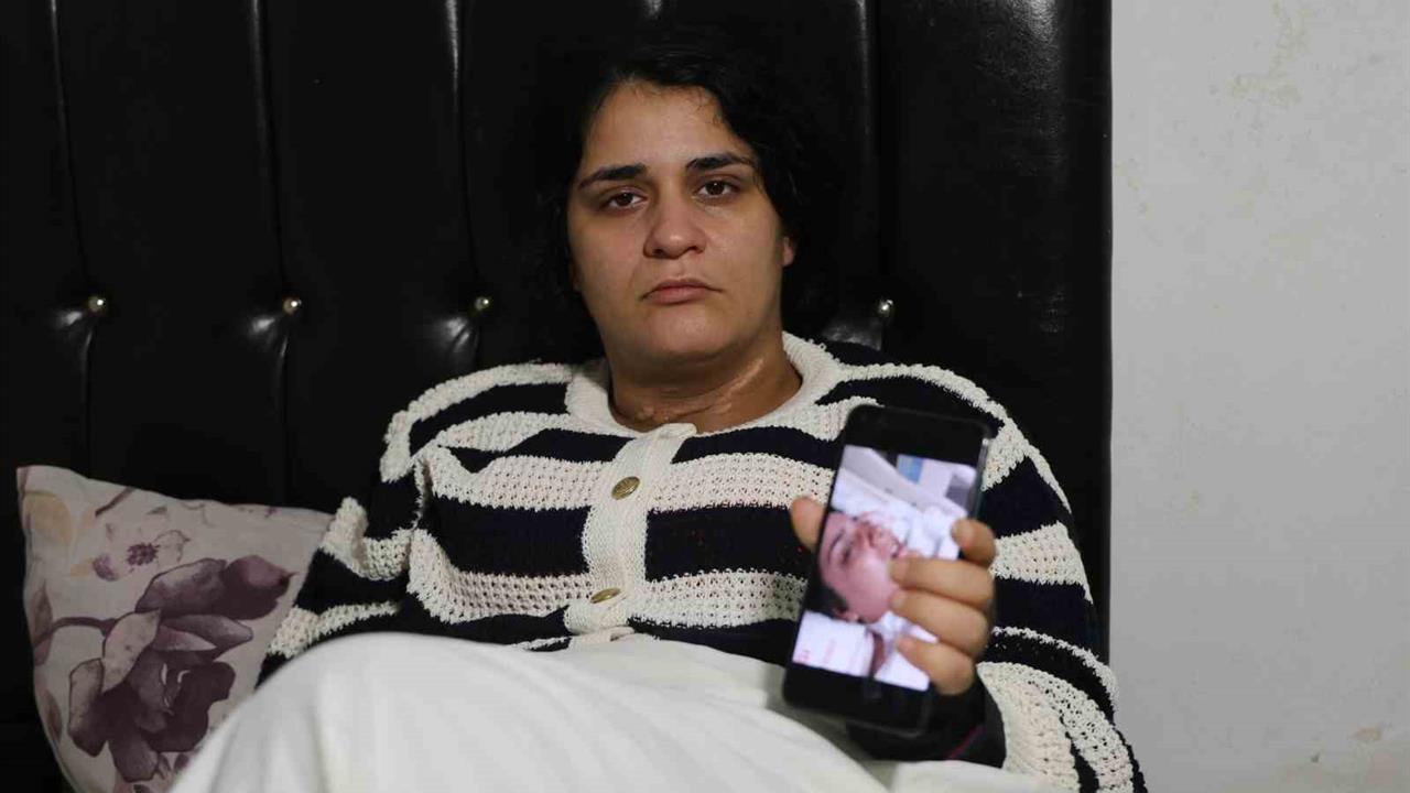 Adana'da 2 Çocuk Annesi Nazmiye Çalışkan, Eşinin Saldırısından Sonra Yaşadığı Korkunç Anları İlk Kez Anlattı.