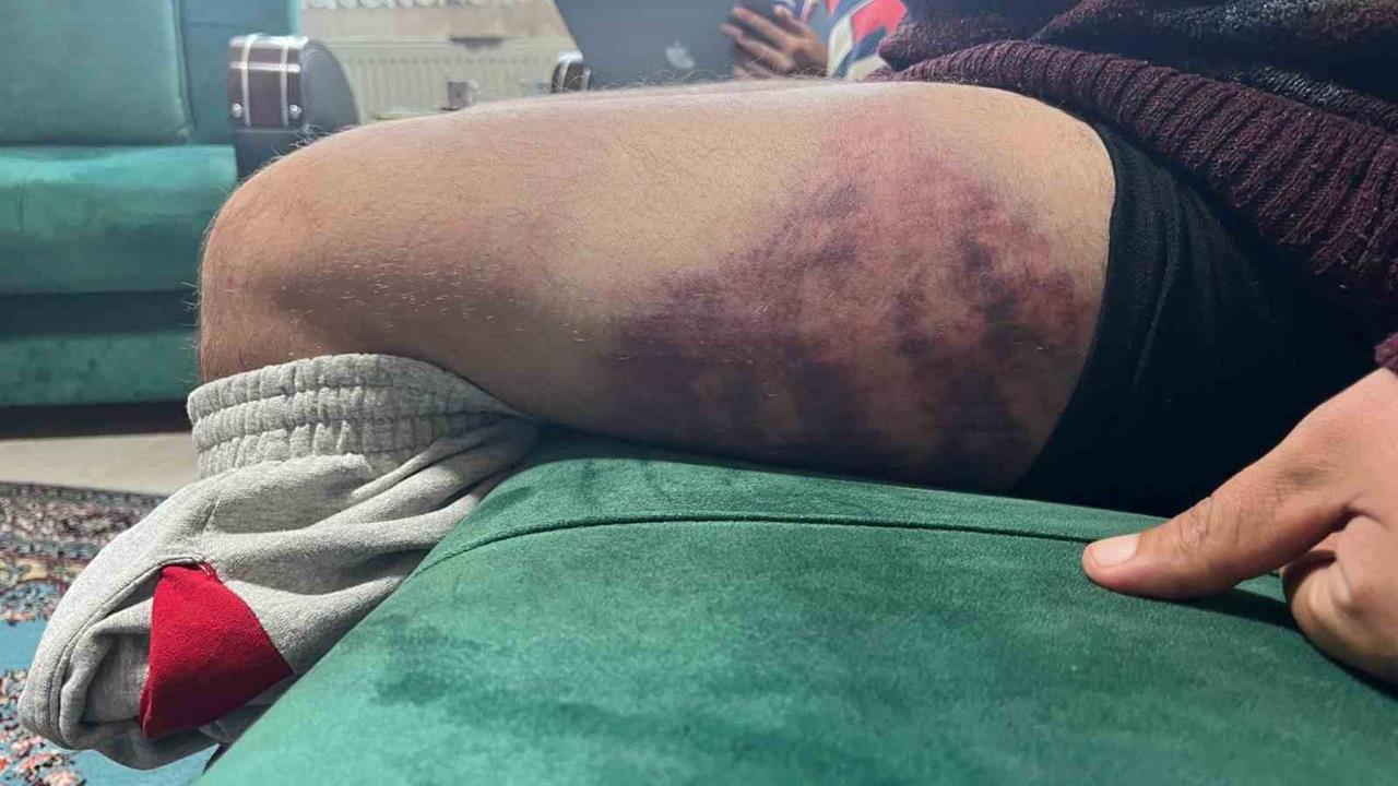 Kocaeli İzmit'te Otizmli Bireye Yapılan Saldırı Tepki Çekti