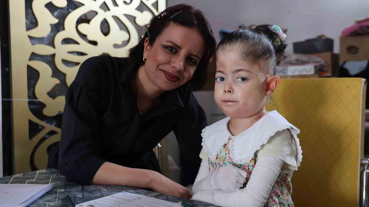 Elazığ'da Kelebek Hastası Fatma, Evde Eğitimle Okuma Sevgisi Kazanıyor