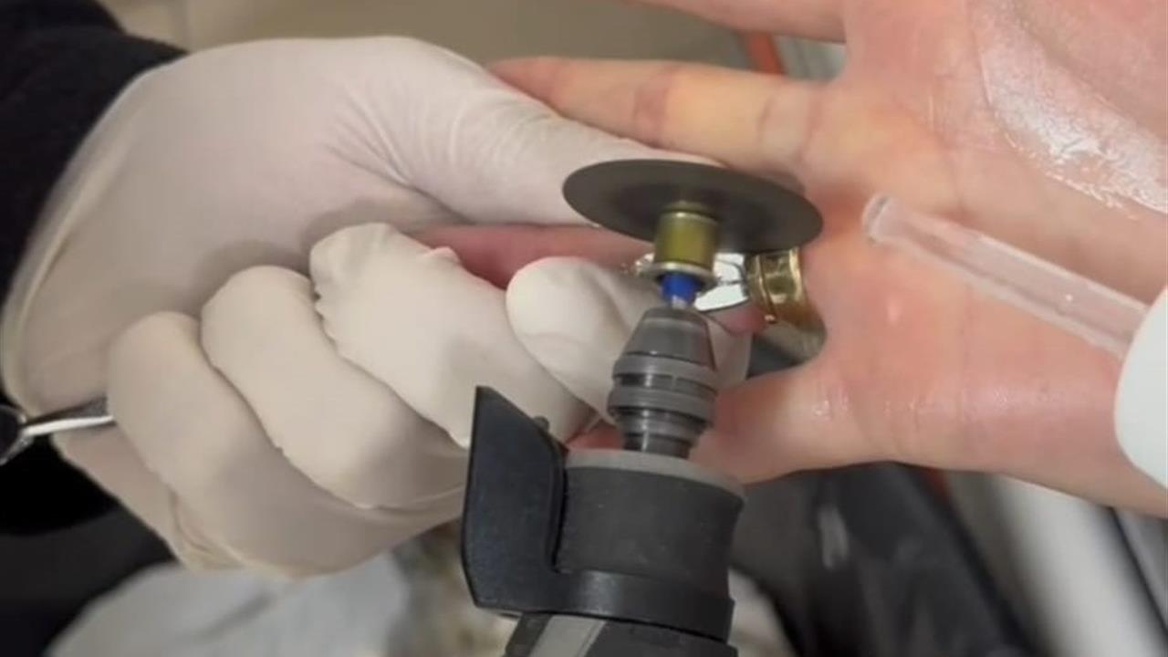 Batman'da Bir Kadının Parmağına Sıkışan İki Yüzük İtfaiye Ekipleri Tarafından Çıkarıldı