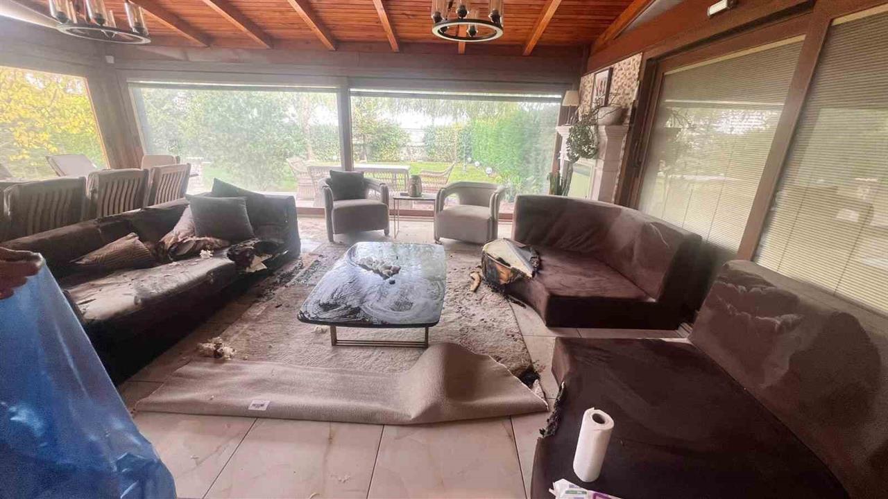 İstanbul'da Dekoratif Şömine Patlaması Sonucu Vücutta Yüzde 30 Yanık Oluştu