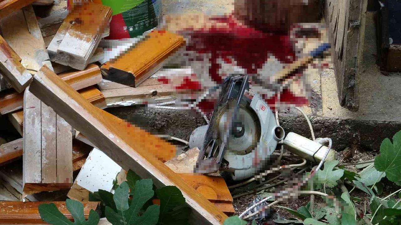 Antalya Kepez'de Elektrikli Testereyle Çalışan Yaşlı Adam Ağır Yaralandı