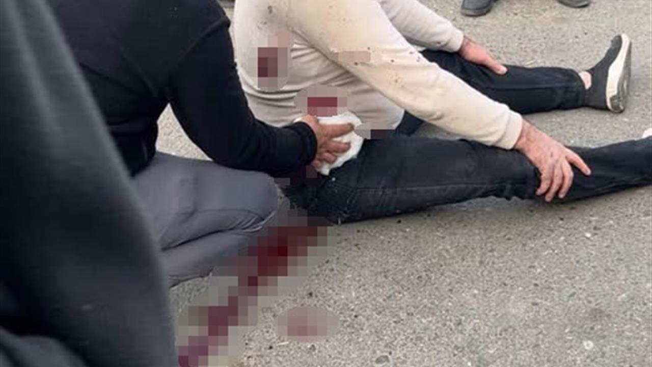 Şanlıurfa Haliliye'de Bıçaklı Kavgada 1 Kişi Ağır Yaralandı