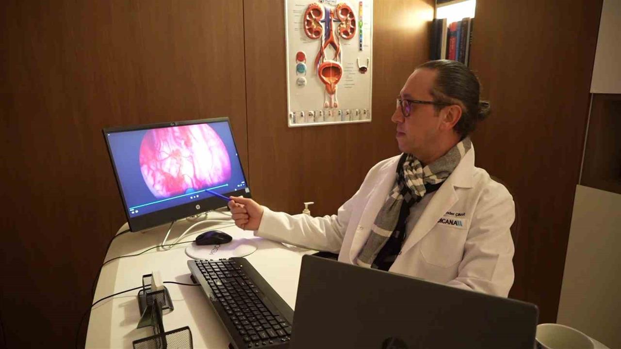Samsun'da Prostat Tedavisinde Holep Yöntemi ile 400 Grama Kadar Prostat Alınabiliyor