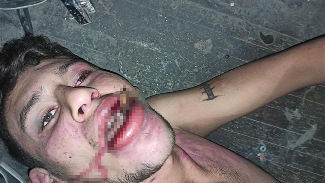 Antalya'da Hamam Böceği Yedirme Davası Sonucu: Yağmadan Beraat, Hürriyeti Tehditten 6 Yıl 12 Ay Hapis