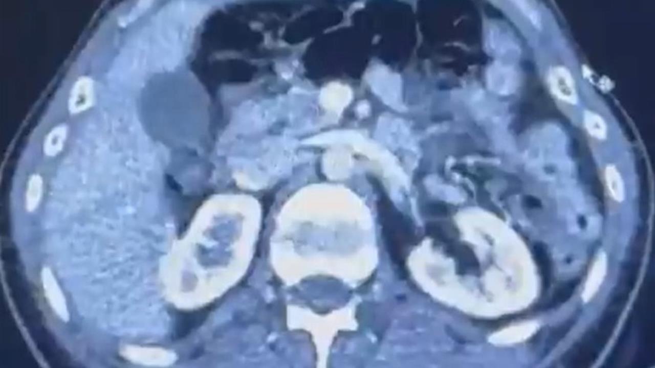 Kayseri'de Yapılan Operasyonda Üç Şahıs Yakalandı ve Uyuşturucu Ele Geçirildi